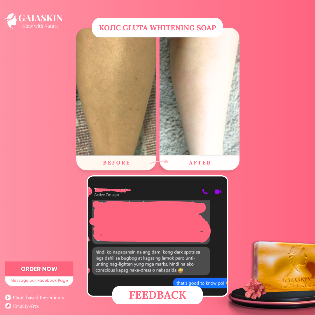 Kojic Gluta Whitening Soap by GaiaSkin