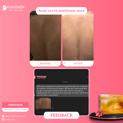 Kojic Gluta Whitening Soap by GaiaSkin