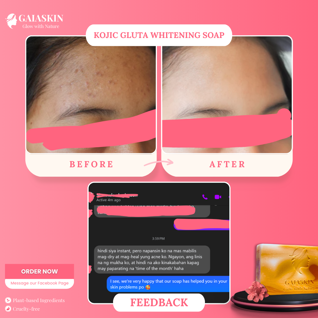 Kojic Gluta Whitening Soap by GaiaSkin