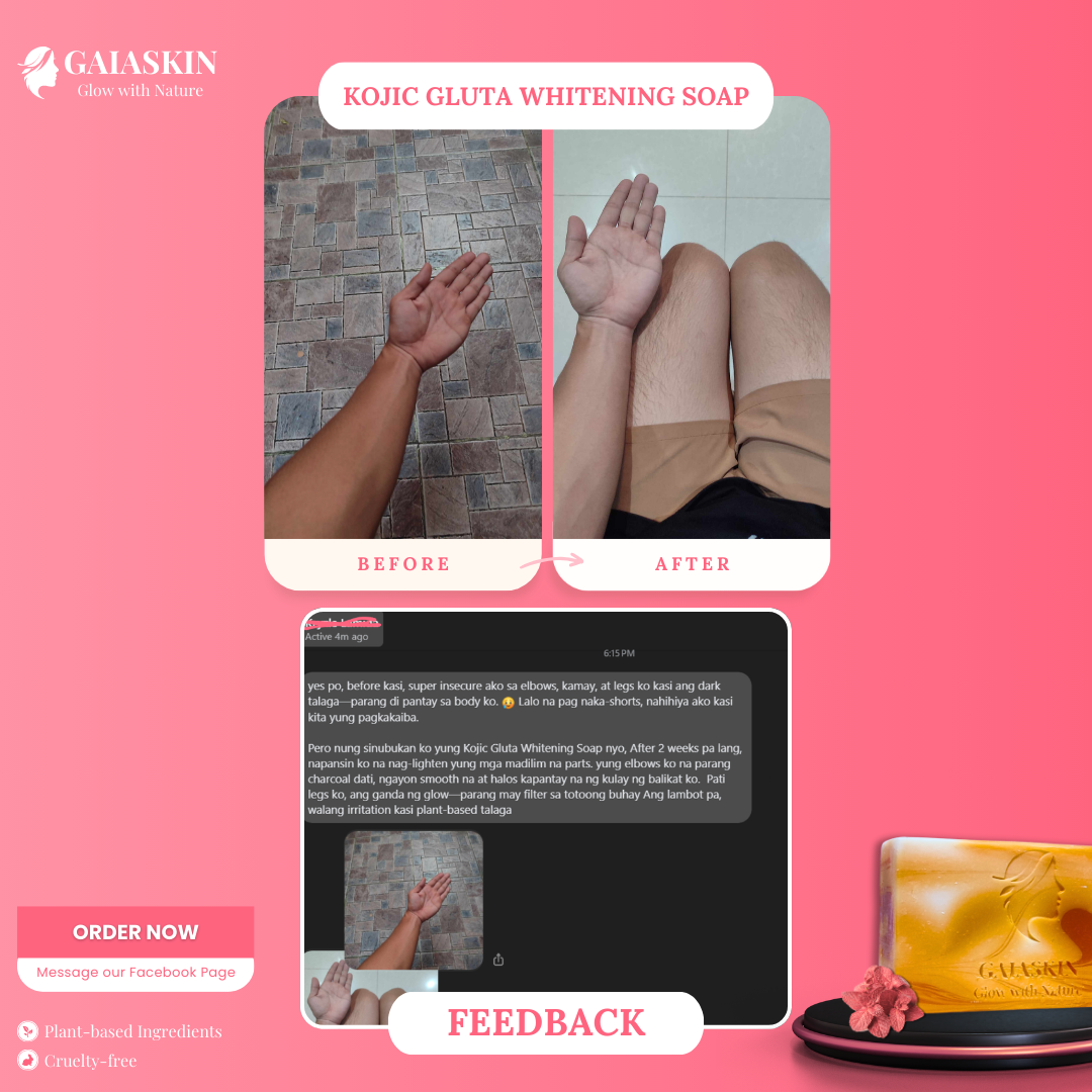 Kojic Gluta Whitening Soap by GaiaSkin