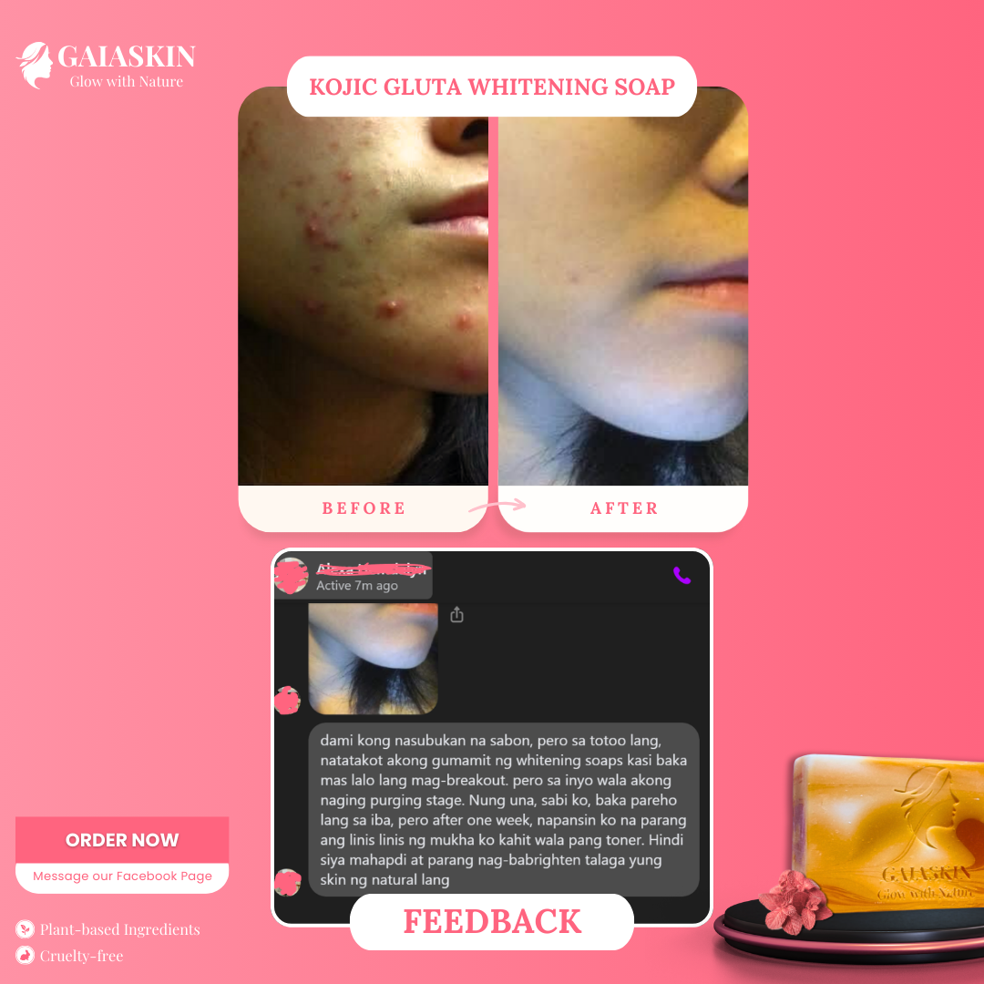 Kojic Gluta Whitening Soap by GaiaSkin