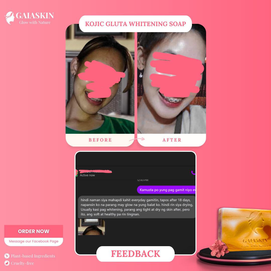 Kojic Gluta Whitening Soap by GaiaSkin