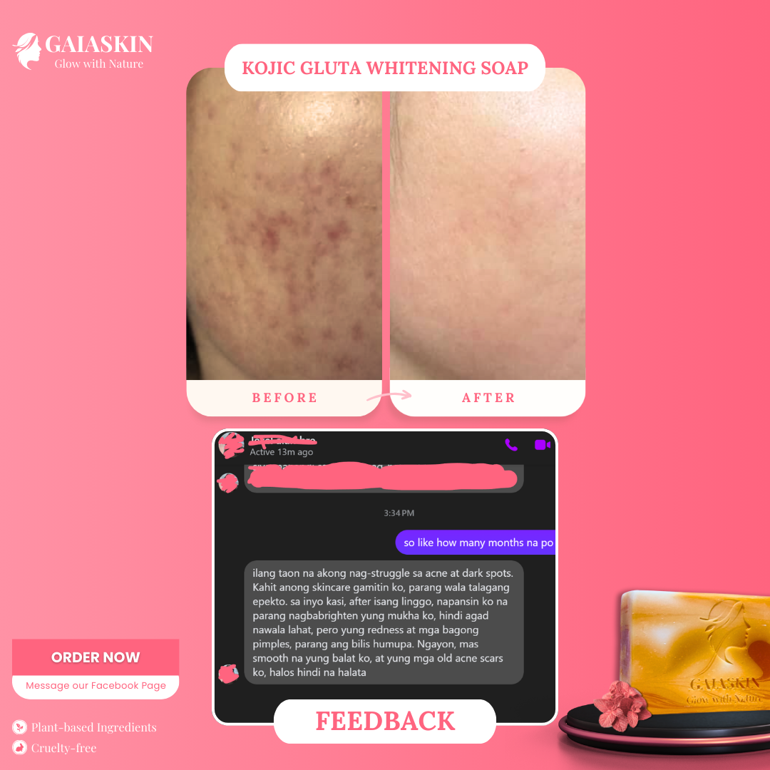 Kojic Gluta Whitening Soap by GaiaSkin