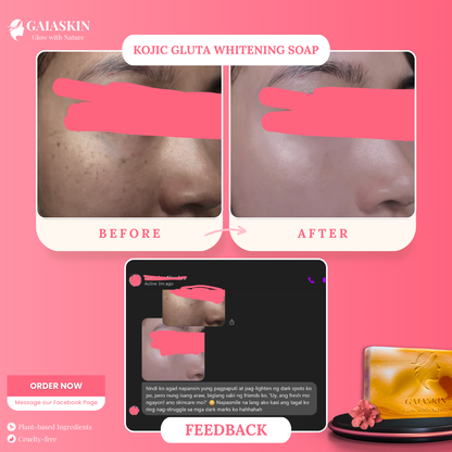 Kojic Gluta Whitening Soap by GaiaSkin